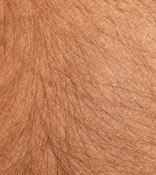 pelos-01